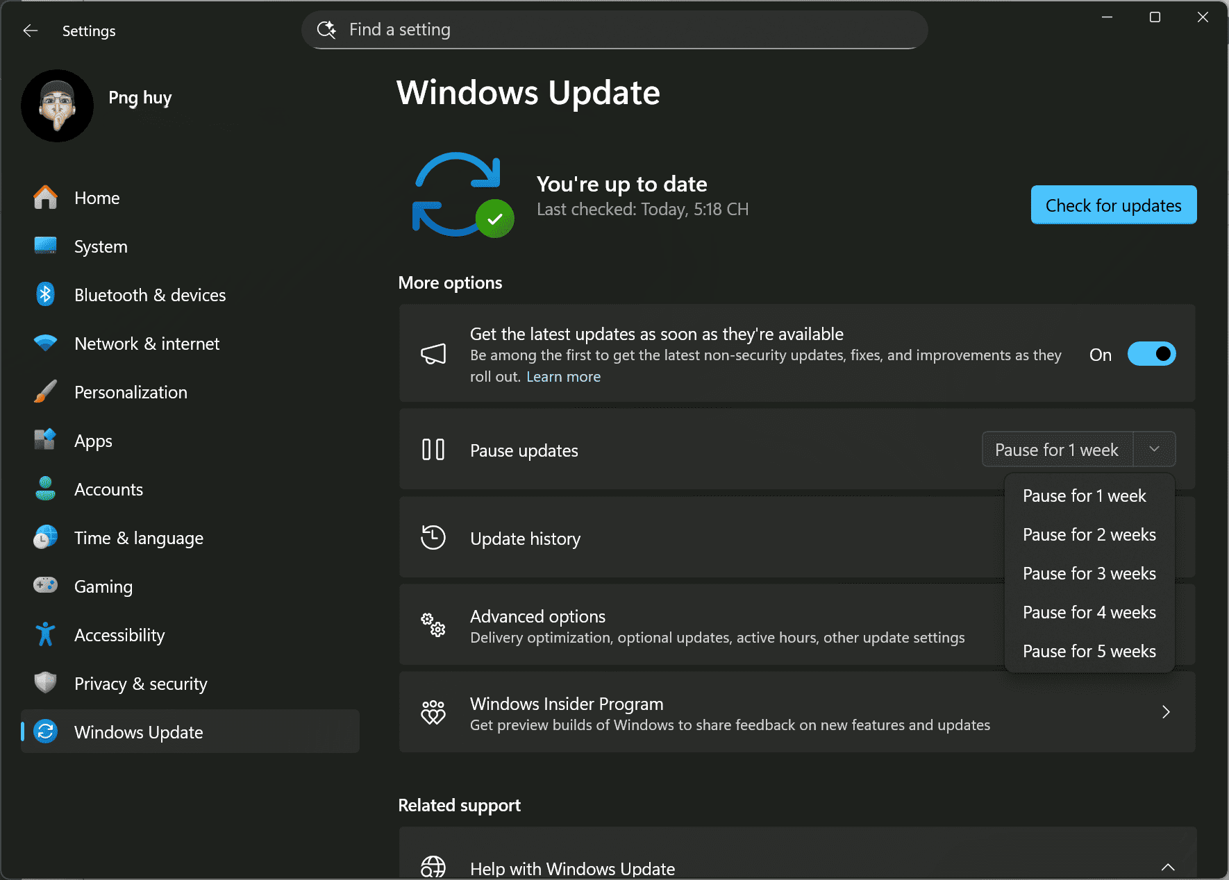 windows-11-7-van-de-microsoft-can-som-cai-thien-de-lam-hai-long-nguoi-dung